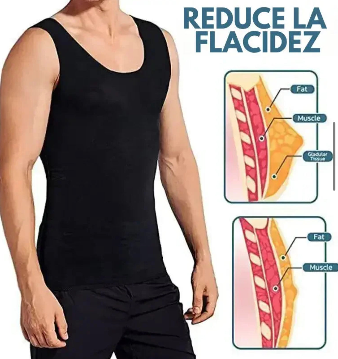 CHALECO DE COMPRESIÓN
